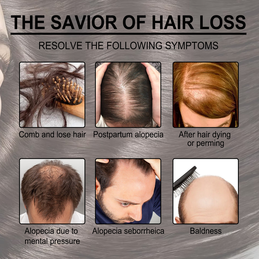 Rosemary Nourishing Hair Care Oil — Anti-Breakage Formula